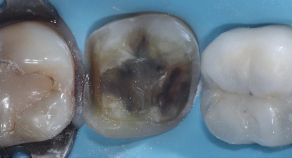 crown-1b