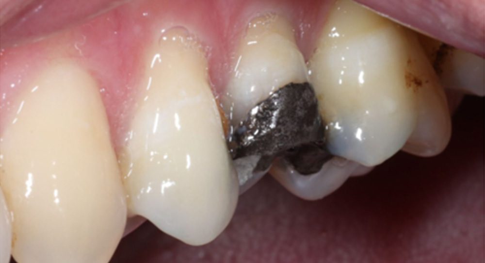 crown-4b